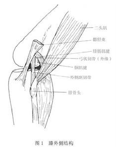 （圖）膝外側韌帶損傷