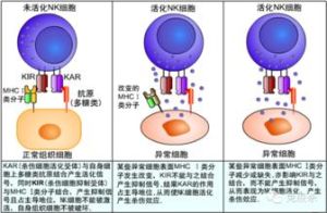 自然殺傷細胞