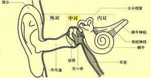 膽脂瘤型中耳炎