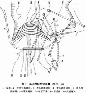 瓦依昂壩