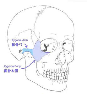 顴弓