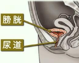 輸尿管炎