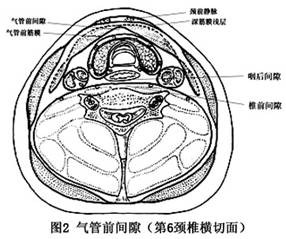 氣管前間隙感染