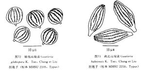 湖北高腹菌