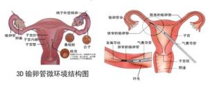 子宮積液