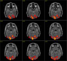 FMRI