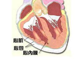 心包積液體徵