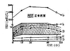 碘131吸碘率