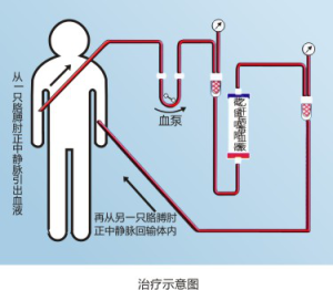 操作方法原理解釋