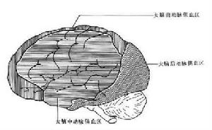 腦血管痙攣