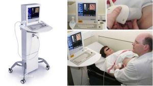 FibroScan