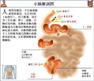 吸收不良綜合徵