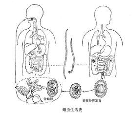 腸道寄生蟲病