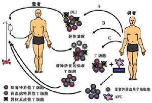 非寄生蟲性肝囊腫