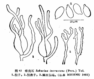 蠟殼耳