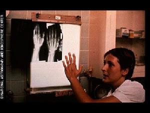 （圖）人類手掌的X光照片