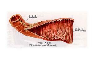 胰腺異位