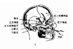 上頜竇根治術