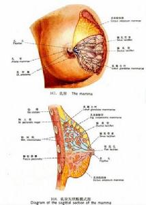 乳腺癌示意圖