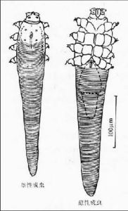 毛囊蠕形蟎