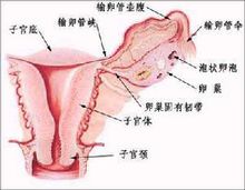 輸卵管腫瘤