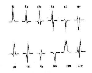正常心電圖
