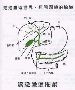 熱郁膽腑證