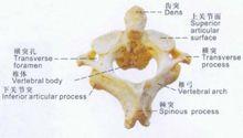 樞椎上方有齒突