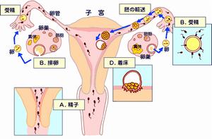 宮角妊娠