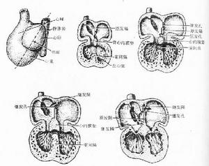 二尖瓣脫垂