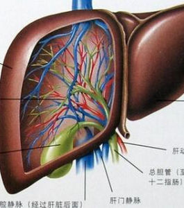 肝硬化頑固性腹水