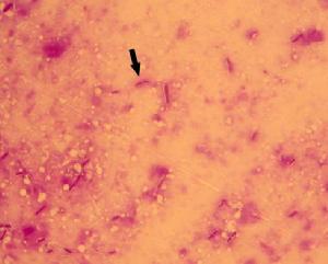 產氣莢膜梭菌形態 革蘭染色