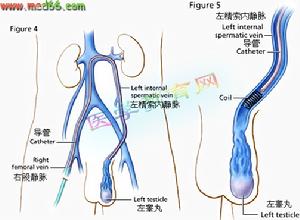 手術圖片