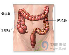 結腸扭轉