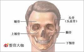 顴骨顴弓整形