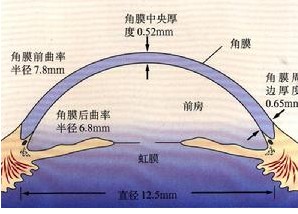 原發性嬰幼兒型青光眼