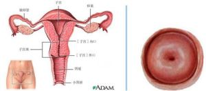 宮頸黏膜炎