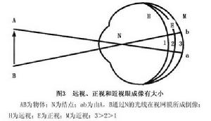 （圖）遠視