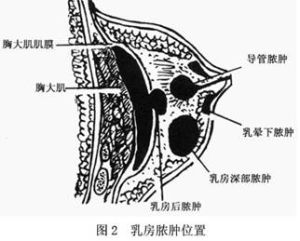 乳腺纖維