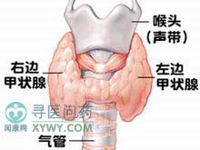 小兒慢性淋巴細胞性甲狀腺炎