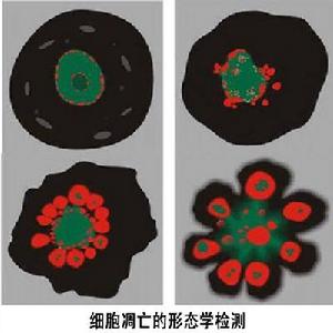 細胞凋亡的形態學檢測