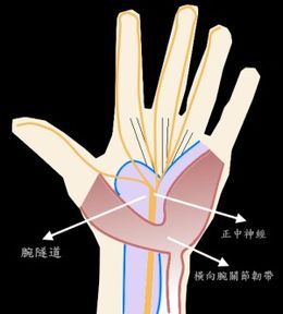 腕隧道綜合症