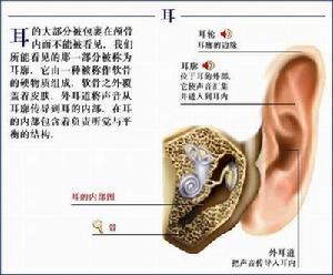 （圖）功能性耳聾