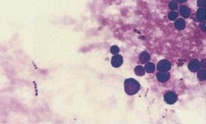 產氣莢膜梭菌（D型）