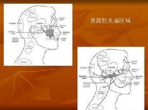 鼻源性頭痛區域