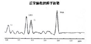 波譜成像