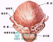 精囊惡性腫瘤