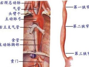 食管賁門黏膜撕裂綜合徵