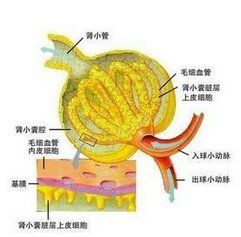 腎小球疾病