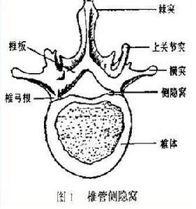 側隱窩